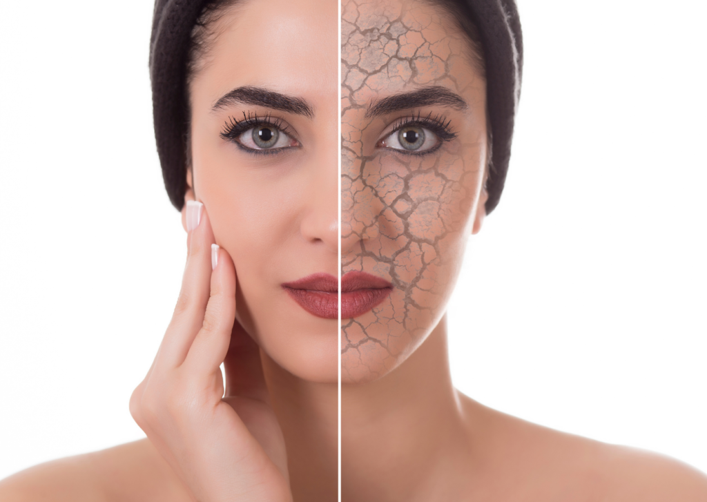 huidherstellende crème: afbeelding van een dame waarvan de helft van het gezicht uitgedroogd is.