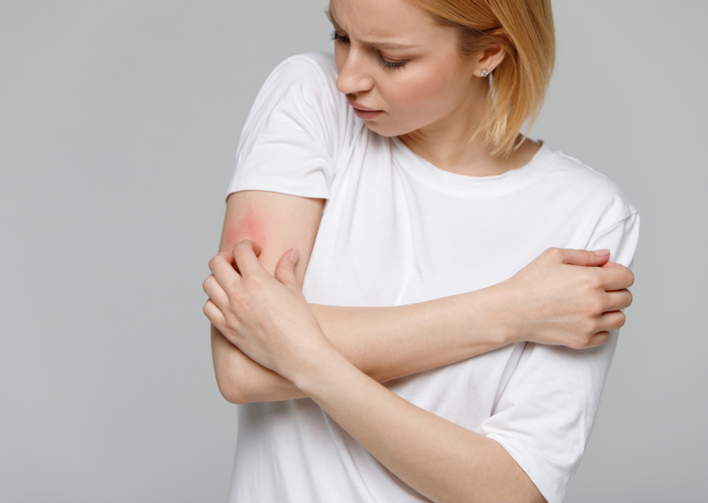 vrouw met een litteken dat jeukt