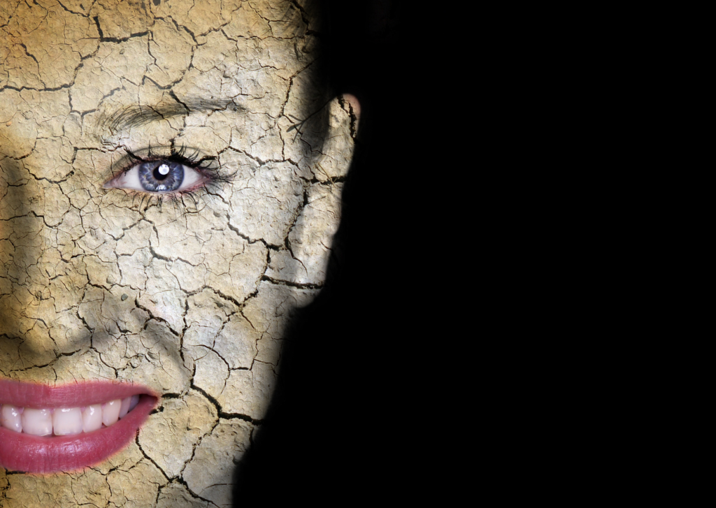 extreem droge huid gezicht