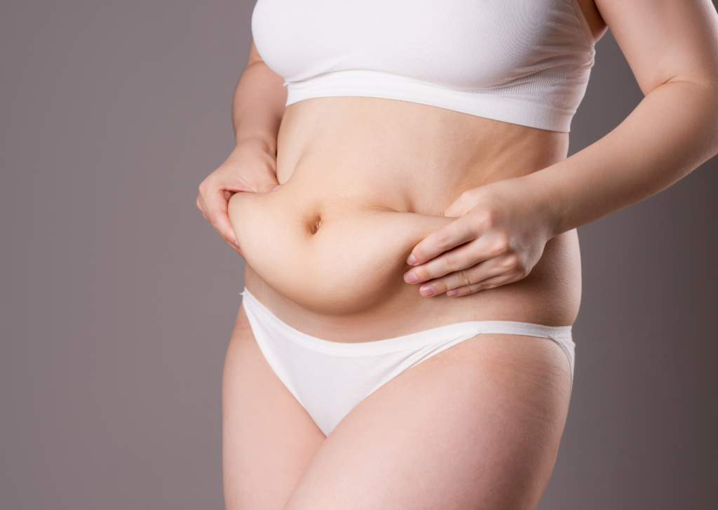 buikwandcorrectie litteken