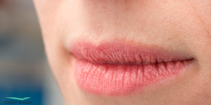 De dunne en kwetsbare huid van je lippen heeft extra hydratatie en verzorging nodig.