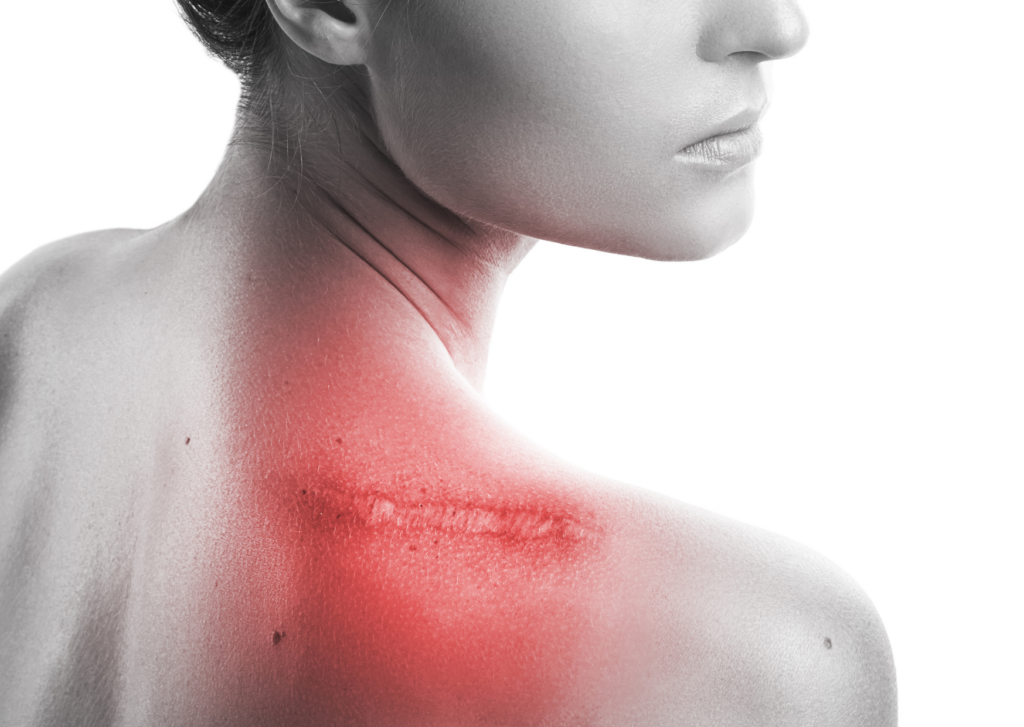pijnlijke littekens