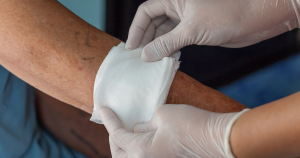 Breng eventueel een gaasje aan indien de wond op een plek zit waar kleding overheen kan schuren.