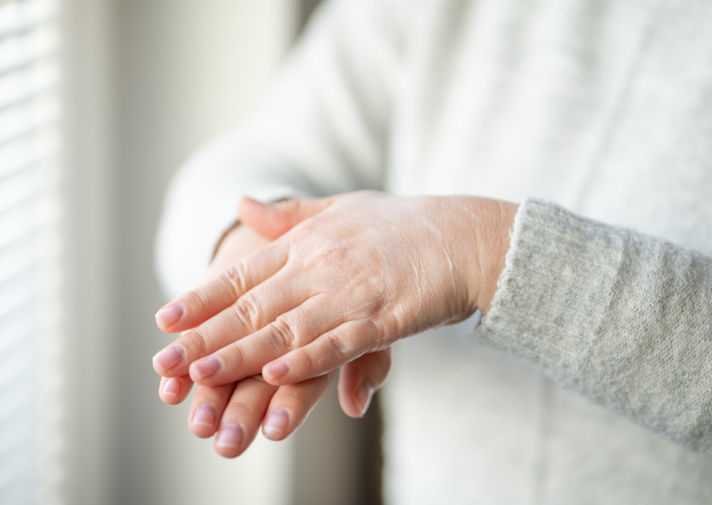 vette crème droge huid