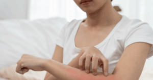 Er zijn verschillende factoren die een brandende huid kunnen veroorzaken