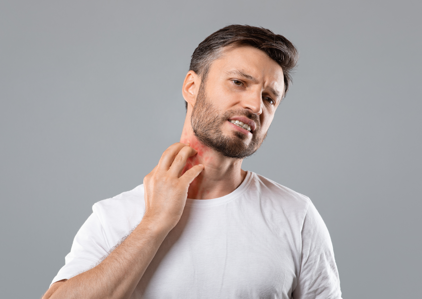 dermatitis behandeling