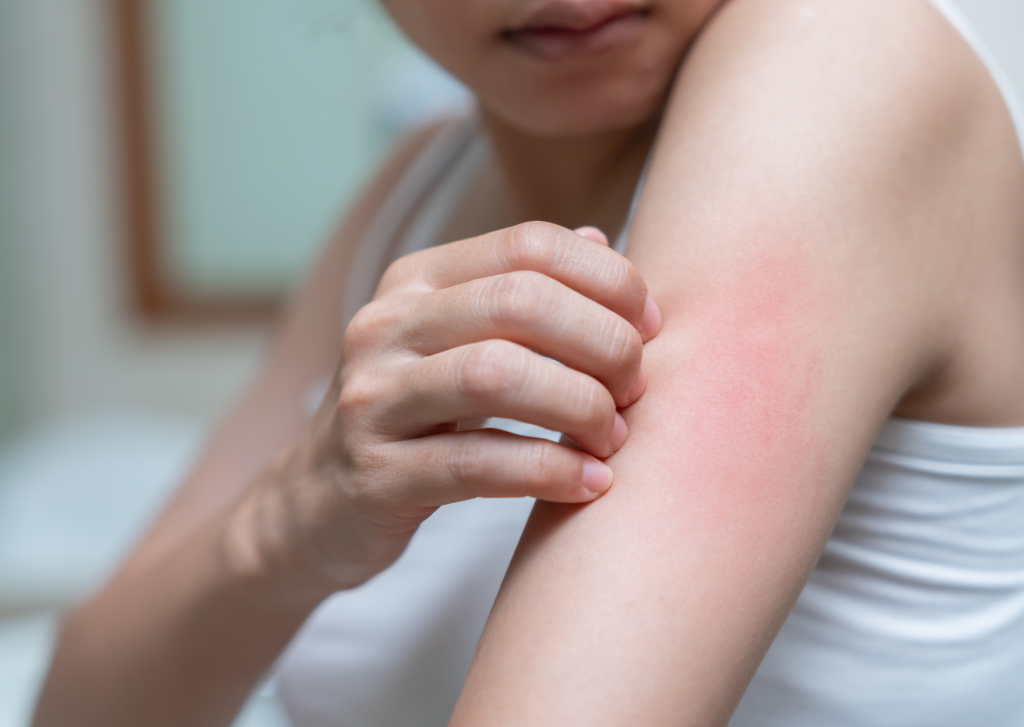 jeuk over hele lichaam