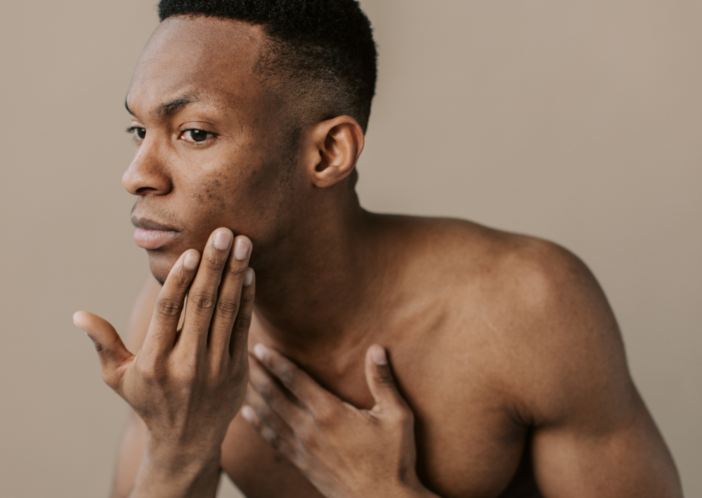 gevoelige huid mannen