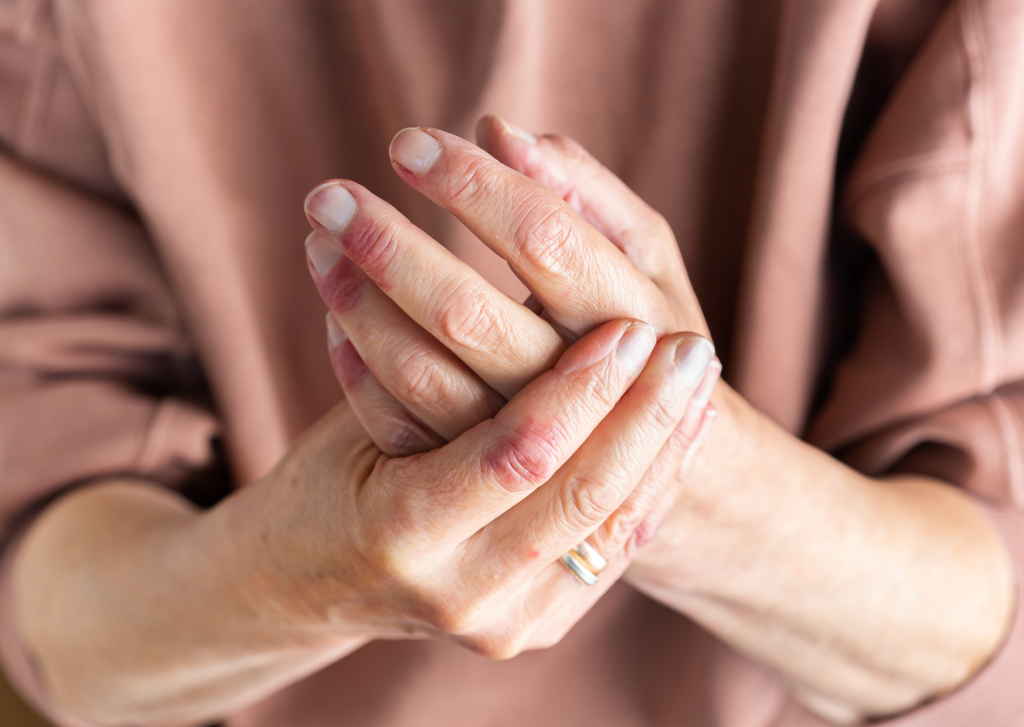 wondermiddel droge huid