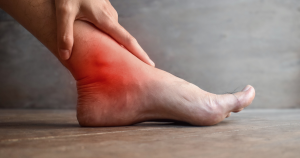 Een plotselinge rode plek, warme huid, pijn of een zwelling kunnen wijzen op wondroos aan de benen.