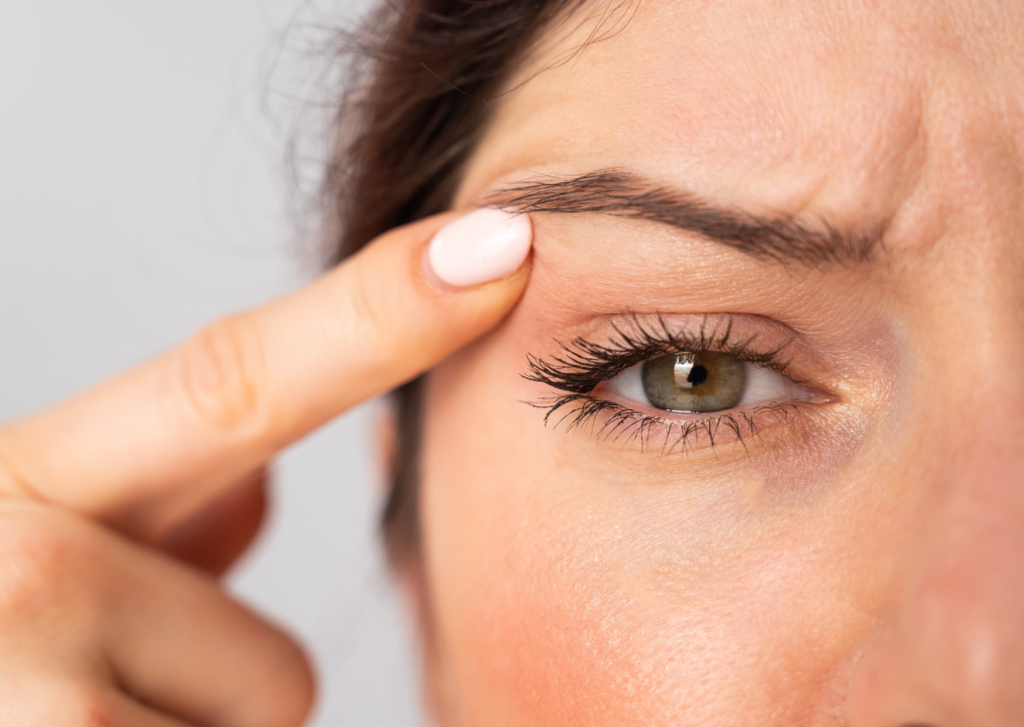 litteken ooglidcorrectie