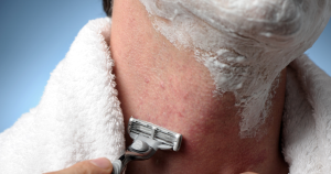 Uitslag na het scheren wordt ook wel scheerirritatie of razor burn genoemd.