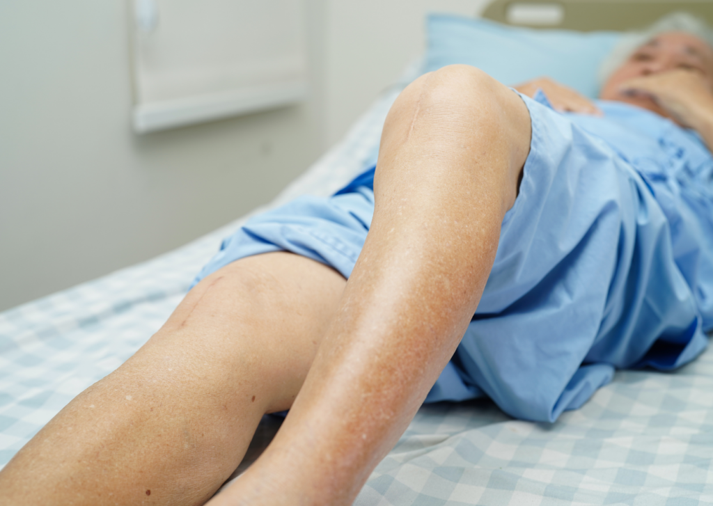 litteken verzorging na operatie