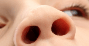 Schilfers neusvleugels: de huid rond je neusvleugels is gevoelig en wordt dagelijks blootgesteld aan kou, wrijving en verzorgingsproducten