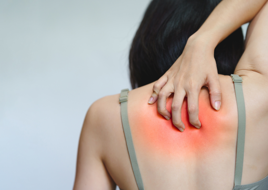 allergische reactie na laserbehandeling