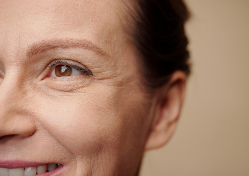 droogtelijntjes onder ogen