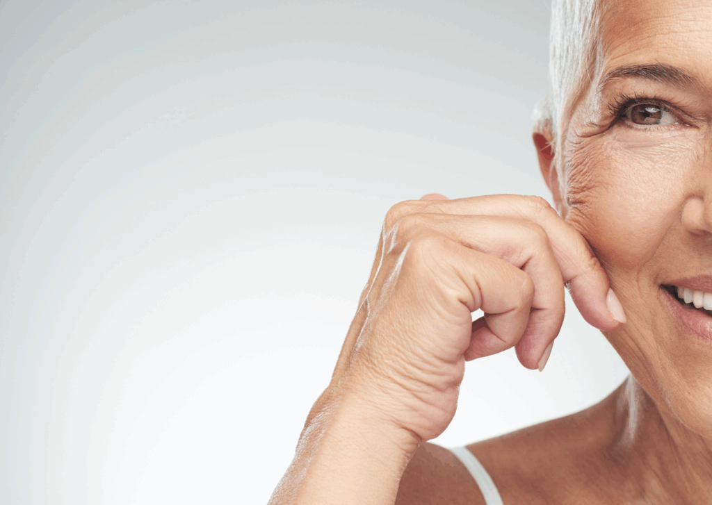 verticale rimpels wangen