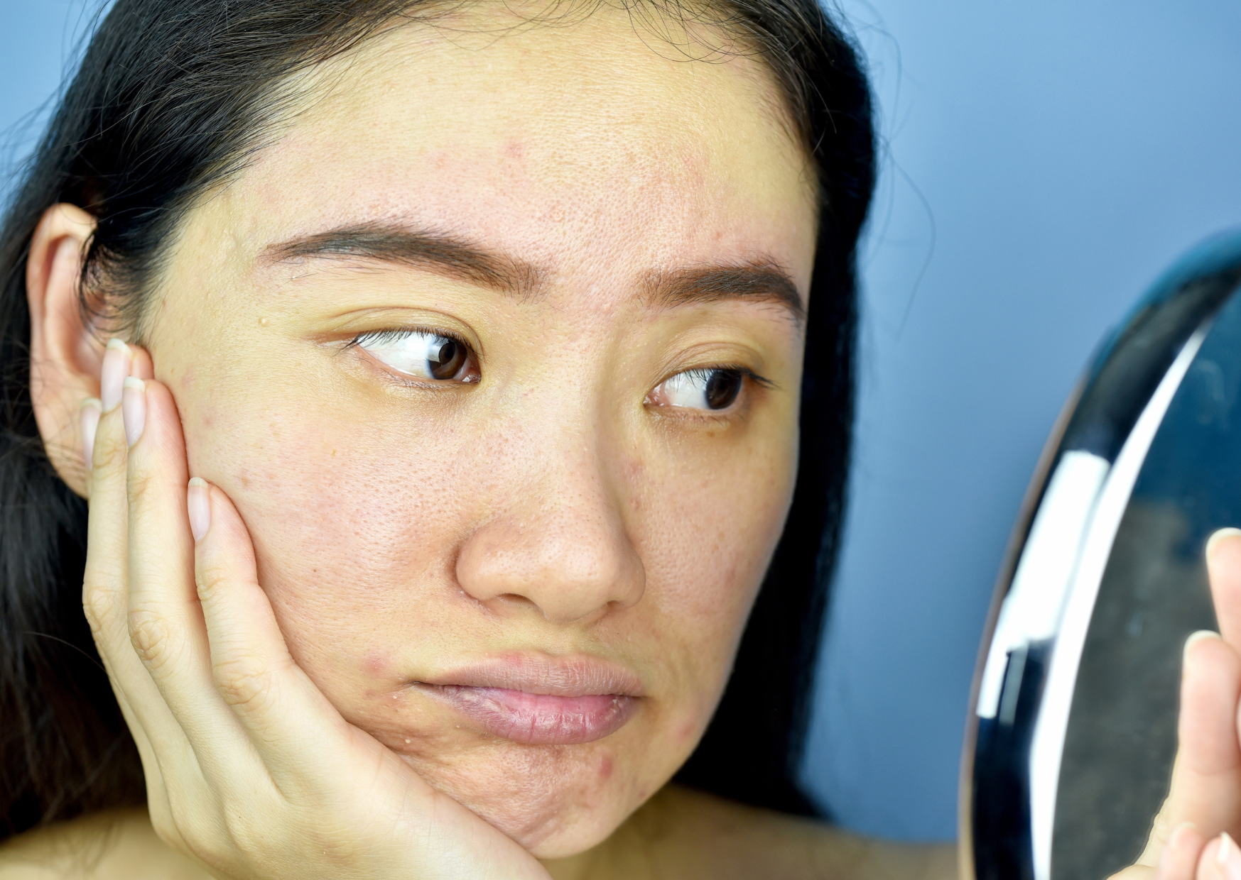 blog thumbnail