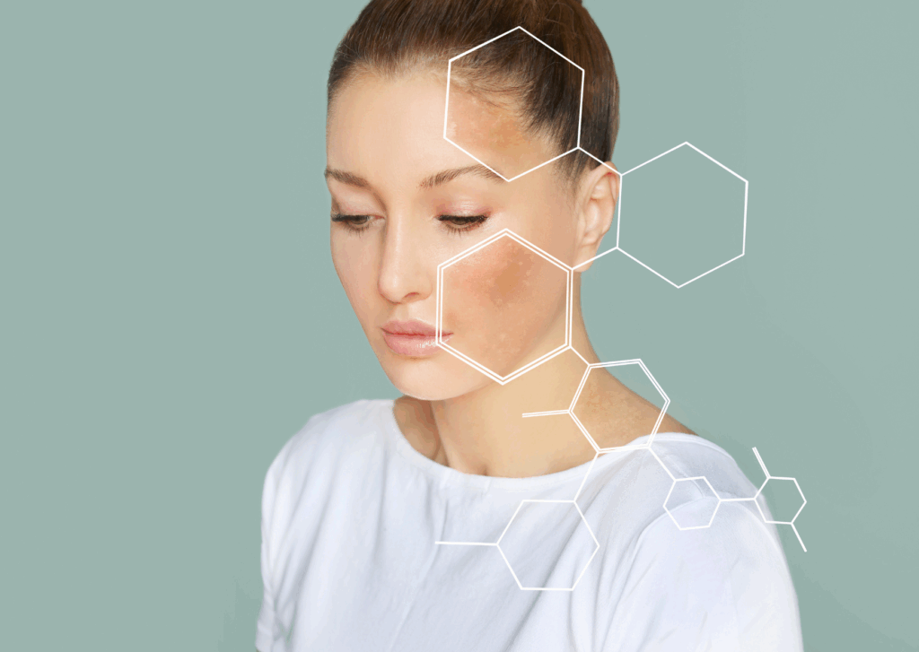 beschadigde huidbarriere