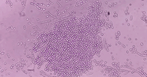 Onder de microscoop is de gist Malassezia zichtbaar. Deze huidgist kan zich uiten in gistpuistjes
