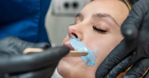 Bovenlip ontharen: Een populaire manier om je bovenlip te ontharen is harsen