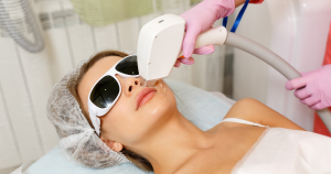 Bovenlip ontharen: Een populaire manier voor blijvende haarreductie is laserontharing