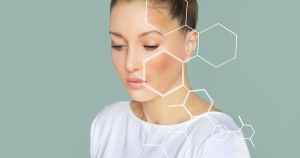 Er zijn verschillende signalen die wijzen op een verstoorde huidbarrière. Door deze op tijd te herkennen, kun je je huid sneller herstellen en klachten beperken.