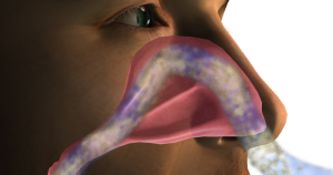 Korsten in neus: Zodra het neusslijmvlies uitdroogt neemt deze bescherming af en raakt de neus gevoeliger voor irritatie en infecties.